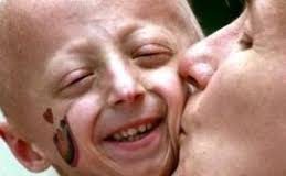 Juntan más de 70 mil firmas para que se reglamente la Ley de Enfermedades Poco Frecuentes