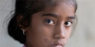 Novartis apuesta fuerte a desterrar la lepra