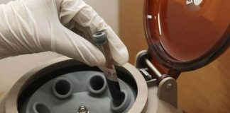 Muestra de sangre reemplazaría a la biopsia