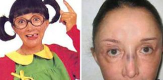 “La Chilindrina” sufre fibromialgia, ¿de qué se trata esta enfermedad?