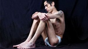 ANOREXIA EN HOMBRES