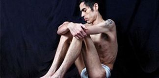 Aumentan los casos de bulimia y anorexia en hombres