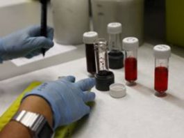 El cáncer de colon ahora es una enfermedad crónica y hasta curable
