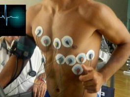 Muerte súbita: qué estudios son necesarios antes de empezar una actividad física