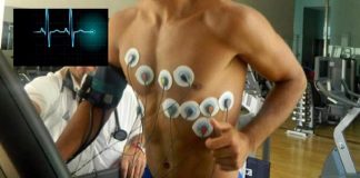 Muerte súbita: qué estudios son necesarios antes de empezar una actividad física