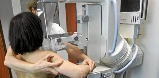 Por qué la mujer debe realizarse una mamografía