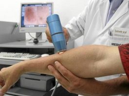 Melanoma: alerta en EE.UU por el aumento de casos de cáncer de piel
