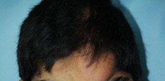 Exitosa cirugía de una malformación en el rostro en el Hospital Eva Perón