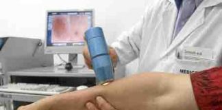 Melanoma: el uso de dos fármacos mejora resultados en tumores de piel metastásicos