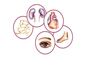 diabetes farmacia