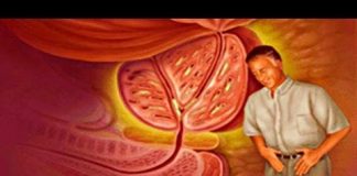 Próstata: a los 50 años los hombres deben visitar al urólogo