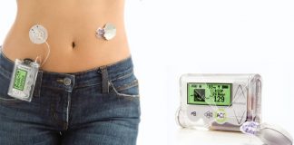 Llega el primer páncreas artificial para diabéticos