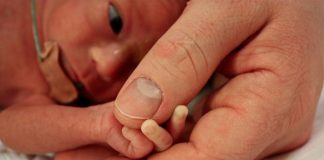 Garantizan el seguimiento del prematuro de riesgo