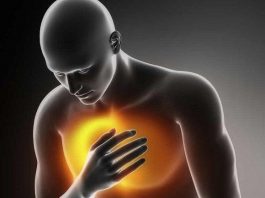 En Argentina hay una elevada mortalidad por infarto