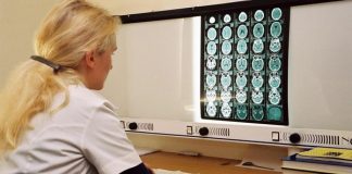 Neurorehabilitación: la aliada para mitigar las secuelas del ACV