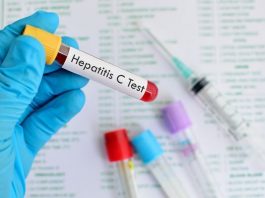 Campaña nacional para detectar casos de hepatitis C