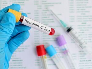 HEPATITIS C 2