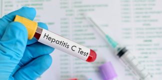 Campaña nacional para detectar casos de hepatitis C