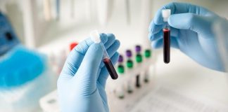 El autismo podría ser detectado con un análisis de sangre y orina