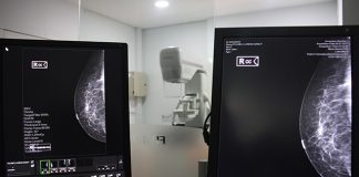 Diagnóstico Rojas donará estudios mamarios a LALCEC