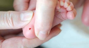 NEONATAL 22