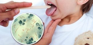 Infección bacteriana: cuándo es necesario consultar al médico