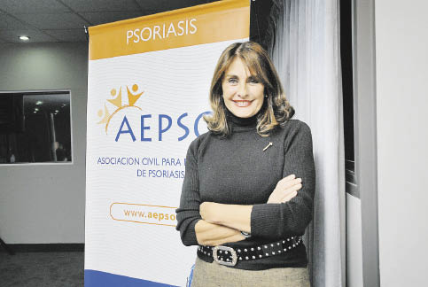 La psoriasis aumenta el riesgo de artritis, infarto, diabetes, cáncer y depresión