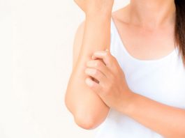 Dermatitis atópica, una enfermedad que pica, duele y es difícil de tratar