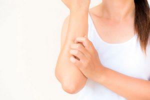 DERMATITIS ATOPICA 444
