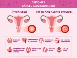 Salud lanzó actividades de prevención del cáncer cervicouterino y del cáncer colorrectal