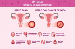 Sintomas+cervical+final_Síntomas+Cervical_Síntomas+Cervical