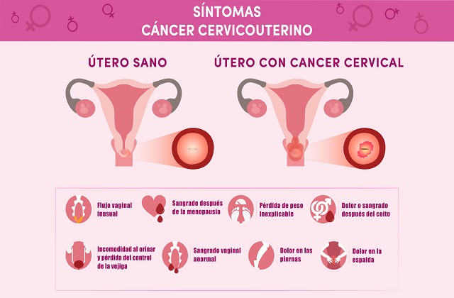 Sintomas+cervical+final_Síntomas+Cervical_Síntomas+Cervical