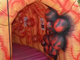 Instalan un colon gigante en el Hospital Udaondo