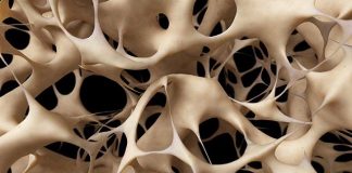 EEUU aprueba nuevo medicamento para combatir la osteoporosis