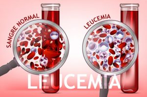 Leukemia horizontal background