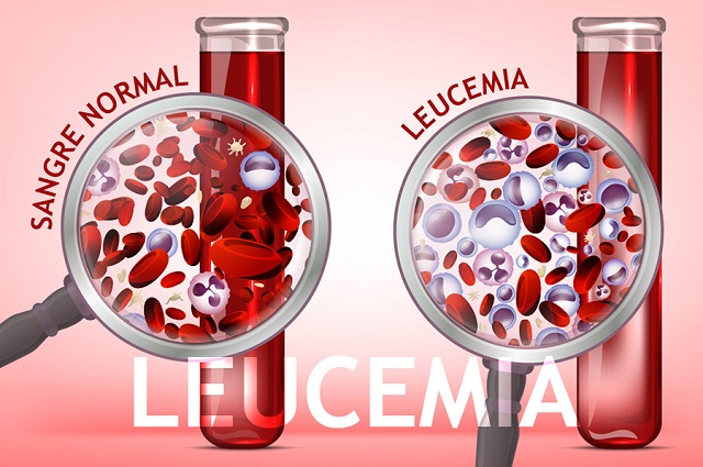 Leukemia horizontal background