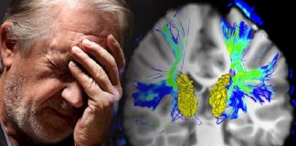 Un fármaco para la hiperplasia de próstata podría frenar el Parkinson