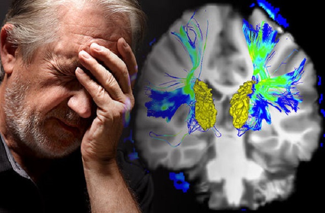 Parkinson-s-disease-symptoms-smell-loss-1038637