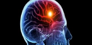 Alzheimer antes de los 50 años: identifican en Argentina una variación genética que causa su aparición