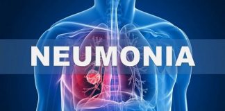 Neumonía: afectaría en Argentina a más de 150 mil adultos por año