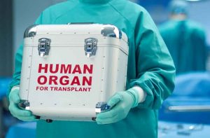 organ-donation