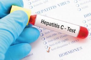 xHepatitis-C-720x479.jpg.pagespeed.ic.5DtuPvAhJh