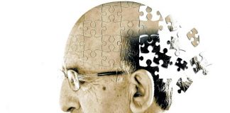 En qué se diferencia la enfermedad de Alzheimer de la demencia senil