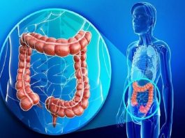 Cáncer de colon: 8 de cada 10 casos se diseminan antes de su diagnóstico