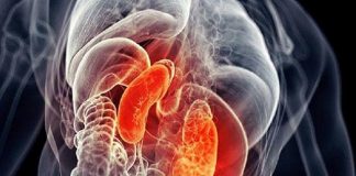 Síntomas para detectar de manera temprana al cáncer de riñón