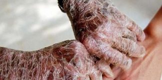 Las EPOF presentes en la 72º Asamblea Mundial de Salud de la OMS