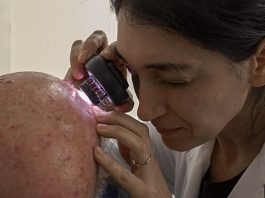 El Hospital Rossi crea una Unidad de Tumores de Piel para mejorar la atención