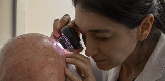 El Hospital Rossi crea una Unidad de Tumores de Piel para mejorar la atención