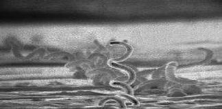 Salud ya capacitó a más de 1.000 agentes de salud para hacer test rápidos de sífilis congénita