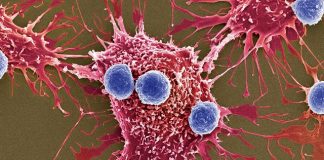 Nuevas armas contra el cáncer: millones de bacterias programadas para matar